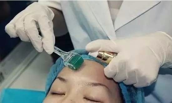 果酸换肤成本与代价揭秘，美丽背后的价格标签
